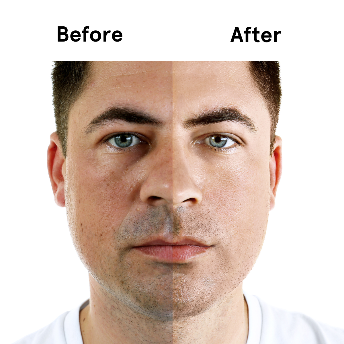 Before and after comparison of a man's face with visible differences.